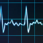 electrocardiogram with heart